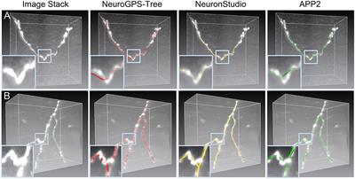 Optimization of Traced Neuron Skeleton Using Lasso-Based Model